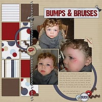 Bumps_Bruises_Copy_.jpg