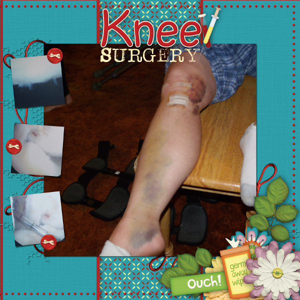 Knee Surgery pg 2